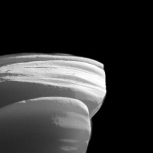 Translucent Zirconia Veneers - Unmatched Strength & Life-like Esthetics