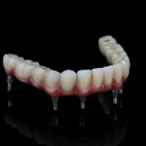Implant DentCare NOVA: Premier PFM Full-Arch Solution (Cobalt-Chrome Base)