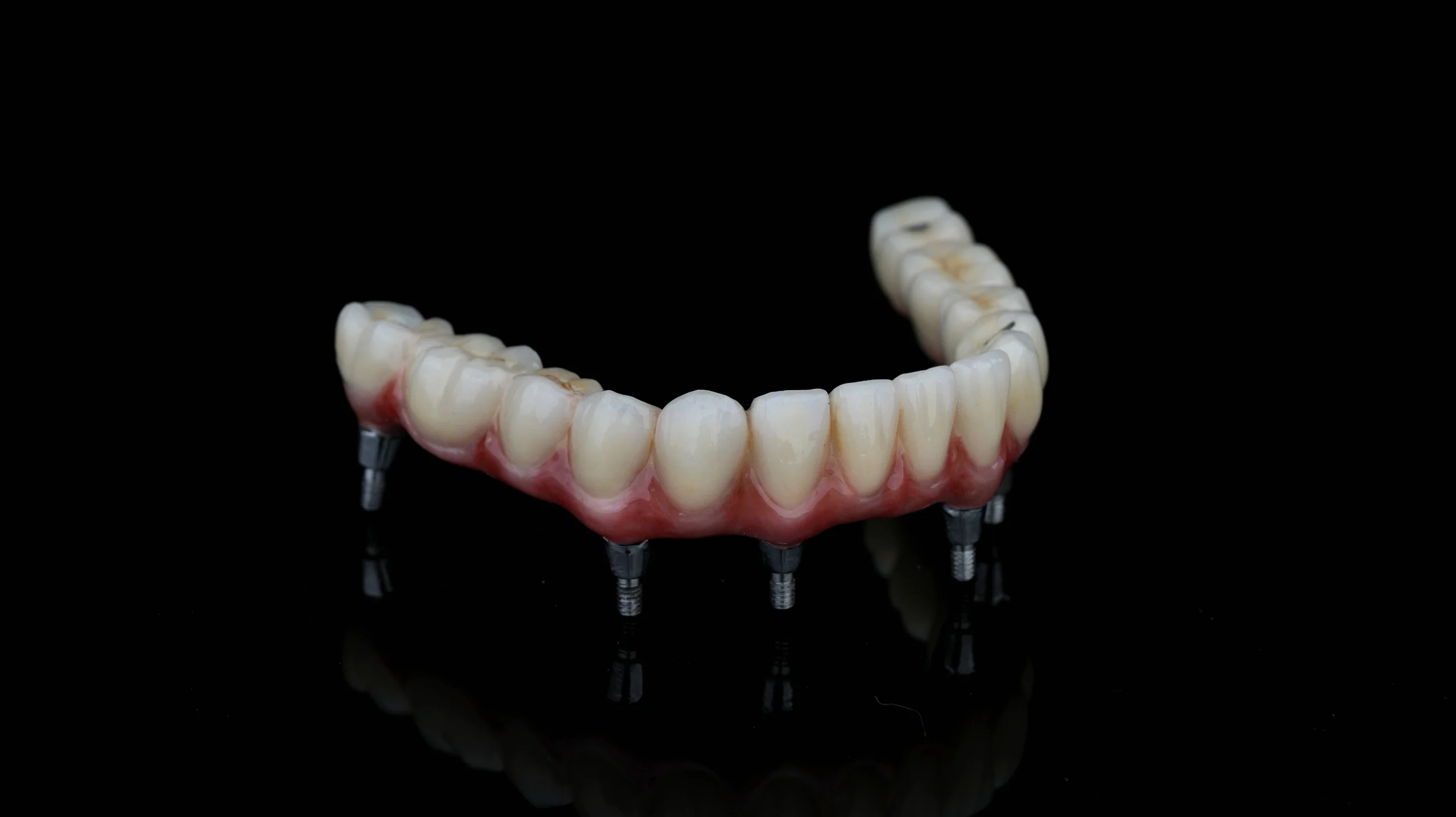 Implant DentCare NOVA: Premier PFM Full-Arch Solution (Cobalt-Chrome Base)