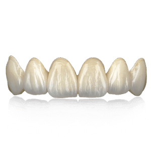 DentCare Zirconia Ultra Plus - Cost-Effective Layered PFZ for Premium Anterior Esthetics